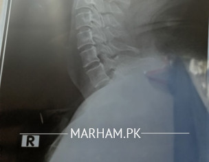 Shoulder Neck Head Light Blur Version