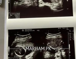 Asking For Gender From 19 Week Scan
