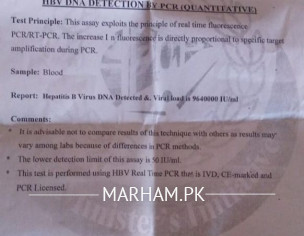 Hepatitis B Test Report