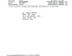 Diffuse Large B-cell Lymphoma