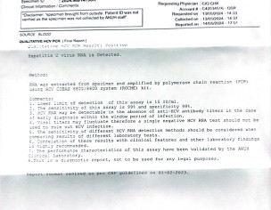 Diffuse Large B-cell Lymphoma