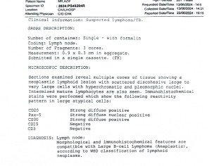 Diffuse Large B-cell Lymphoma