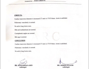 Seeing Some Heart Issue