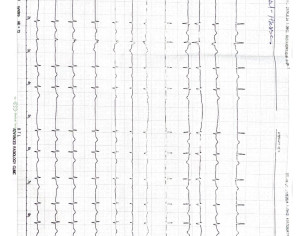 Seeing Some Heart Issue