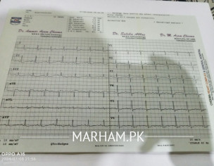 Ecg
