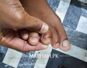 Dog Bite Confirmation 