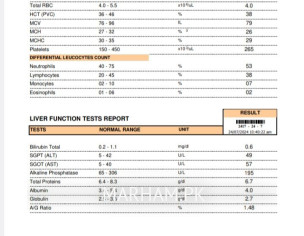 Chk My Cbc And LFT Report