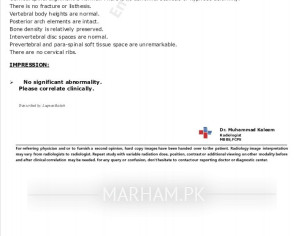 Scoliosis Back Bone Issue