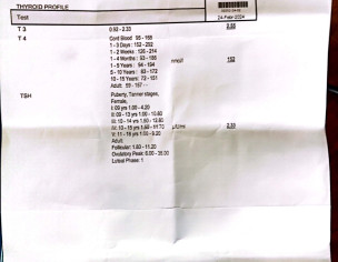 Swelling Under Both Ears