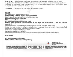 Sinocitus Depration Etc