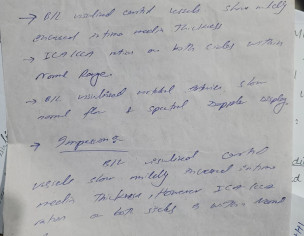 Paralysis On Right Side