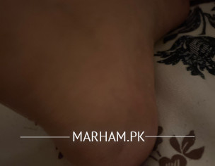 Feet Pain- Knee Pain