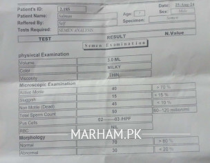 Semen Analysis Test