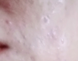 Comedoganic Prone And Prone Skin