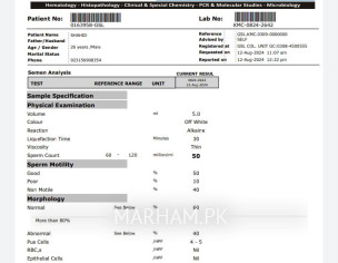 Deficiency Of Testosterone
