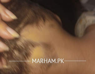 Dermatologist Please Check