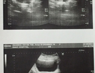 Pain In Lower Back And During Intercourse