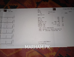Fast Heartbeat/high Pulse Rate