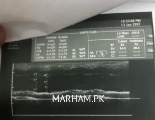 Heart Report Explanation