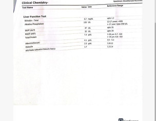 Swelling In Lower Leg