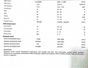 Swelling In Lower Leg