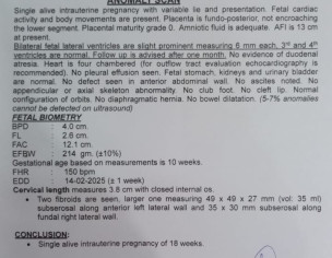 Lateral Ventricle Range 6mm
