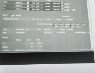 Lateral Ventricle Range 6mm