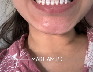 Dental Issue