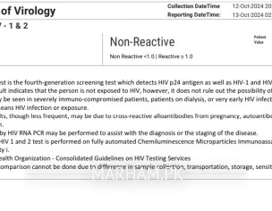 Hiv Test Results Analysis 