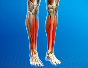 Pain Lower Leg Front Side