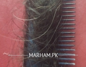 Hair Fall Problem