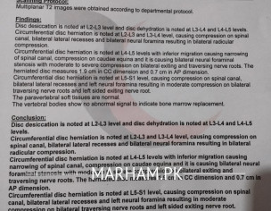 Nerve And Spine Problem