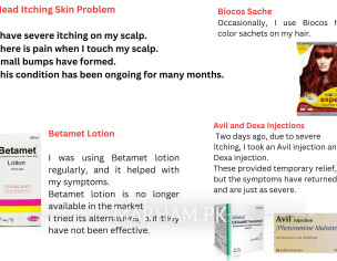 Head Itching - Skin Problem