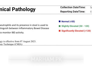 IBS-D For Past 7 Months