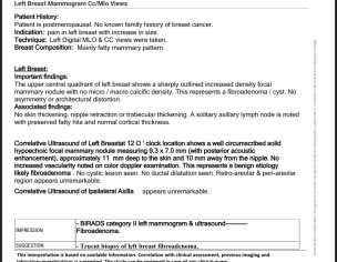 Mammography Result