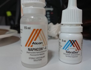 Eye Rash,eye Itching