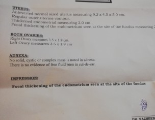Irregular Menstrual Cycle 