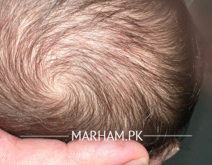 Head Was Hit On The Door