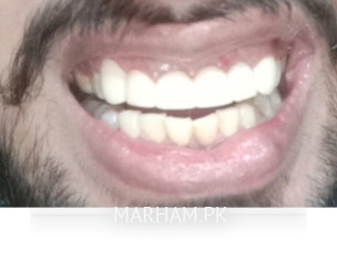 Accident (Physiotherapist)