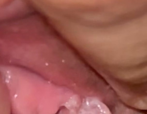 Vaginal Growth Like Tissue