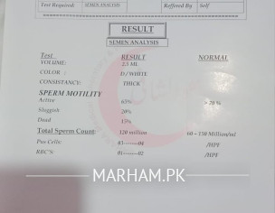 Semen Analysis Report