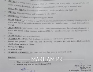 Prostate Calcification