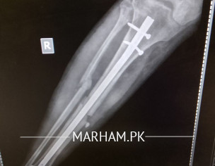 آ رتھو پیڈک.