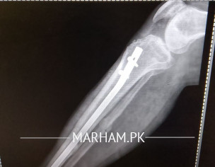 آ رتھو پیڈک.