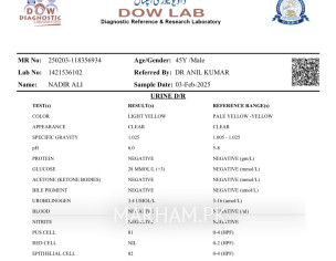 Glucose In Urine