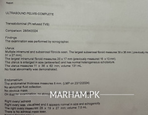 Heavy Menstruation+ Fibroid