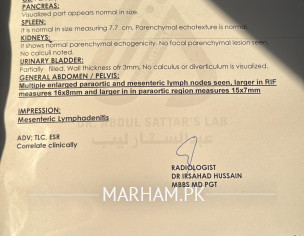 Lymphnodes In Neck And Stomach