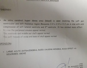 Brain Hemorage