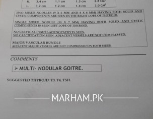 Goiter.... Cholesterol