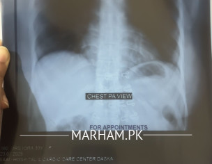 Cough For A Long Time 